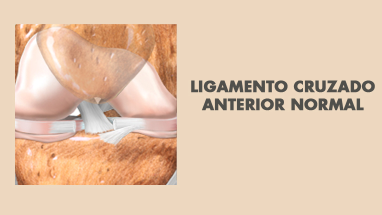 Lesionado